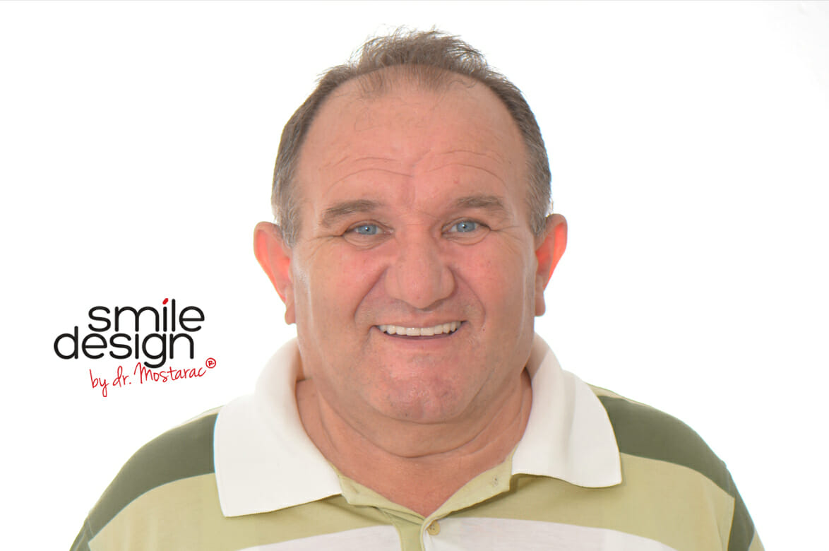 smile design by dr. Mostarac