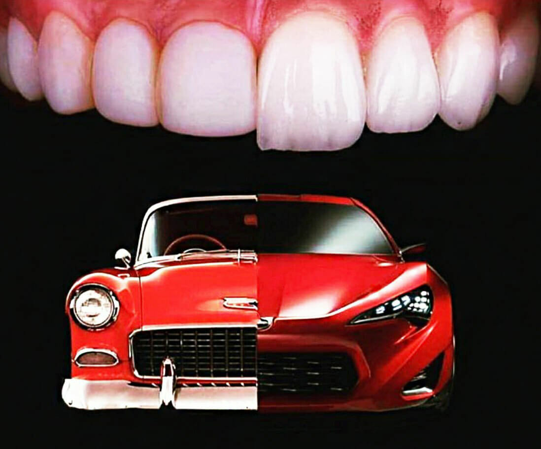 usporedba zuba s autima